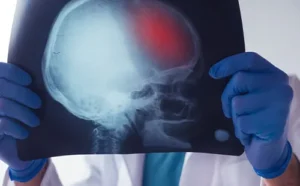 Broomfield Traumatic Brain Injury Lawyer